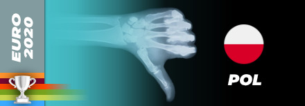 Arkadiusz Milik forfait